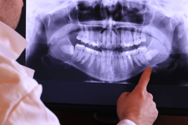 Best Cracked Tooth Emergency Dentist  in Speers, PA