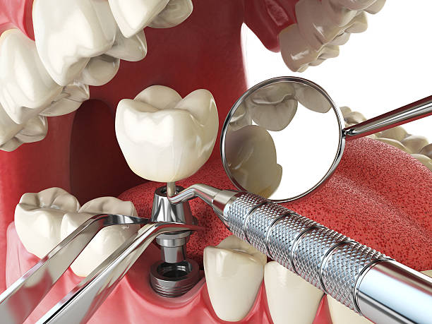 Best Dentist for Dental Trauma  in Speers, PA